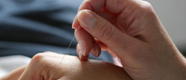 Hand | Akupunktur | Leistungen der HNO im Isartal, Dr. Theda Balzer