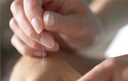Akupunktur  - HNO im Isartal